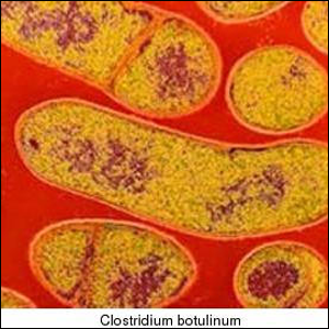 Stained microscope image of Clostridium Botulinum